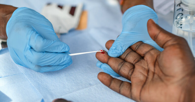 The Trump administration considers the downsizing of the HIV efforts to the CDC