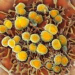 FDA Gives Green Light to Two New Gonorrhea Treatments