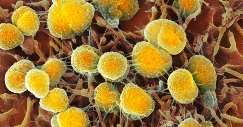 FDA Gives Green Light to Two New Gonorrhea Treatments