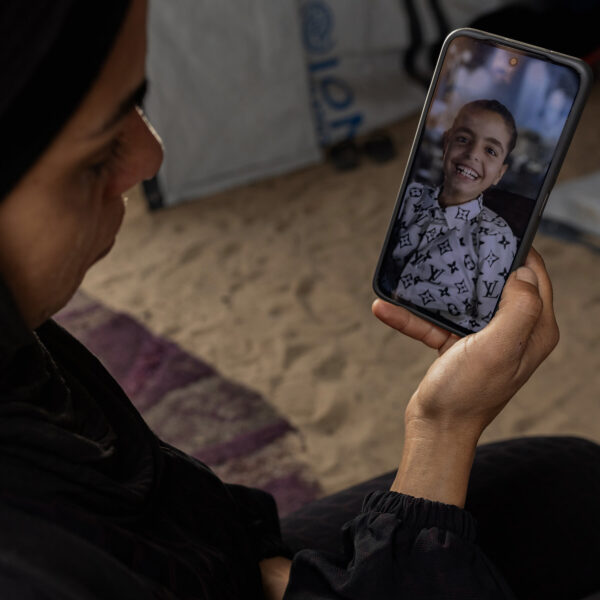 A Gazan Girl’s Struggle Against Severe Hunger