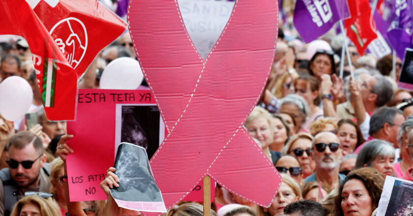 Risk Tabanlı Tarama, 40 Yaş Sonrası Meme Kanserini Bulmada Yıllık Kontrollerle Eşdeğer Çalışıyor